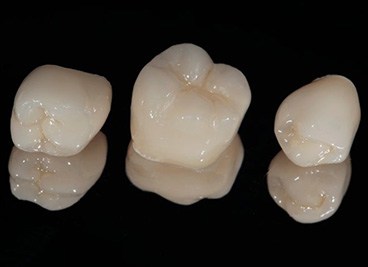 Dental crowns