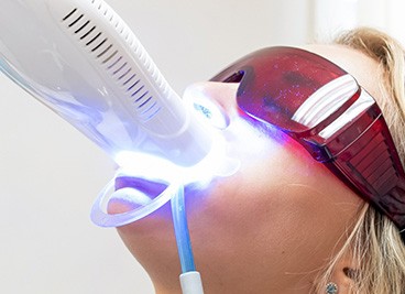 Woman undergoing in-office teeth whitening treatment