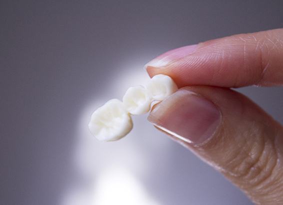 A hand holding a dental bridge