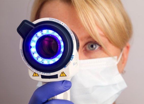 Dental team member holding scope used for oral cancer screenings