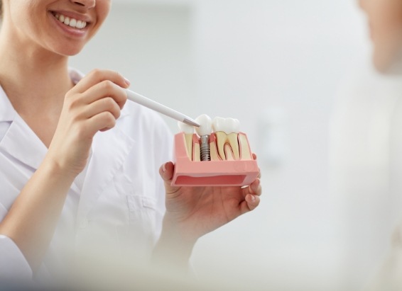 Dentist showing a patient a model of dental implants