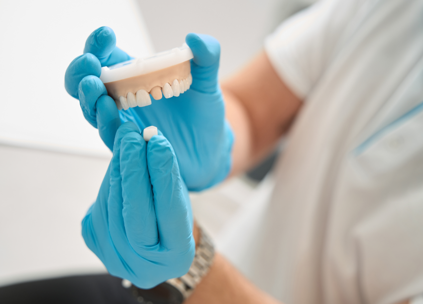 Dentist holding dental crown model